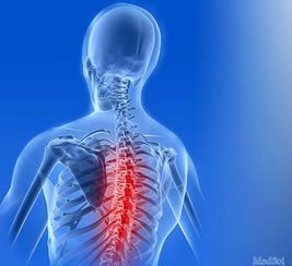 强直性脊柱炎：非常容易被“误诊”的一种疾病